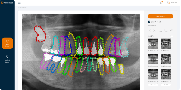 歯式検出画面イメージ